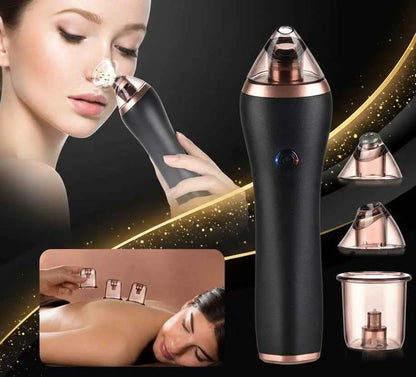 4-in-1 Blackhead Remover - Guasha Cupping Facial Pore Cleansing Device velvet vial