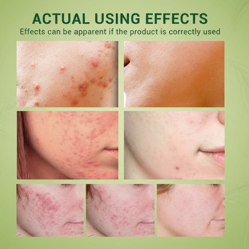 Collage of skin before and after using a product on a green background