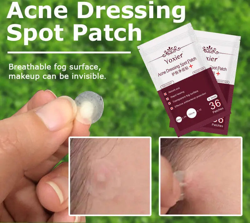 Invisible Acne Pimple Patches - Hydrocolloid Spot Treatment Stickers velvet vial