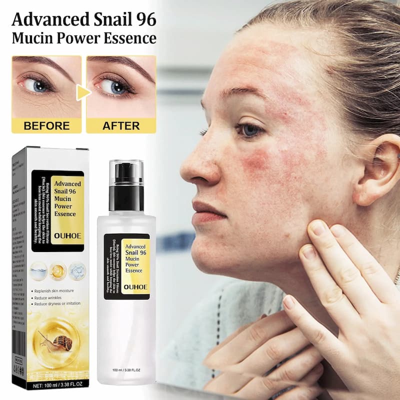 Skincare product with packaging and before/after effects on skin