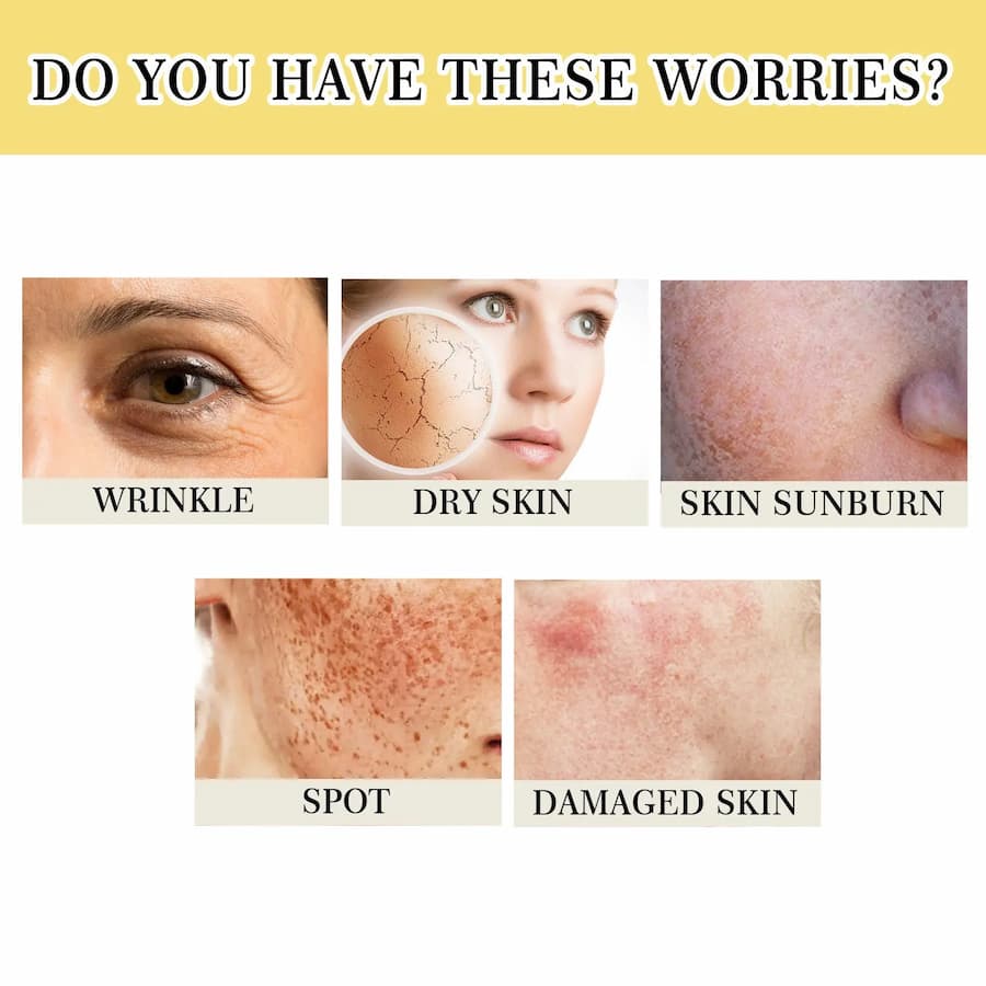 Illustrations of skin concerns including wrinkles, dry skin, sunburn, spots, and damaged skin with text asking if these are worries.