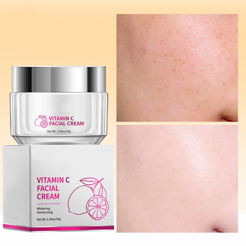 Vitamin C facial cream with packaging and before-and-after skin comparison on a beige background