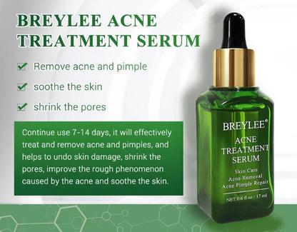 Acne Treatment Serum - Facial Repair Oil with Green Tea & Botanical Extracts velvet vial
