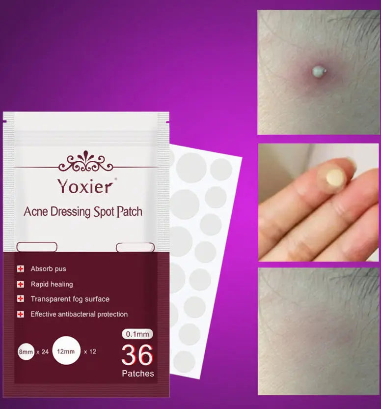 Invisible Acne Pimple Patches - Hydrocolloid Spot Treatment Stickers velvet vial