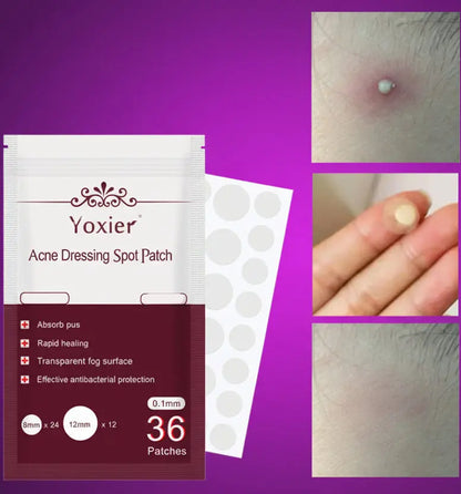 Invisible Acne Pimple Patches - Hydrocolloid Spot Treatment Stickers velvet vial